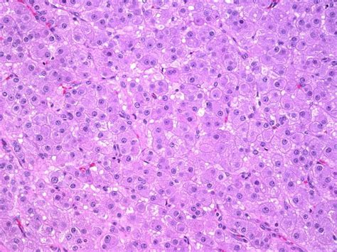 webpathology